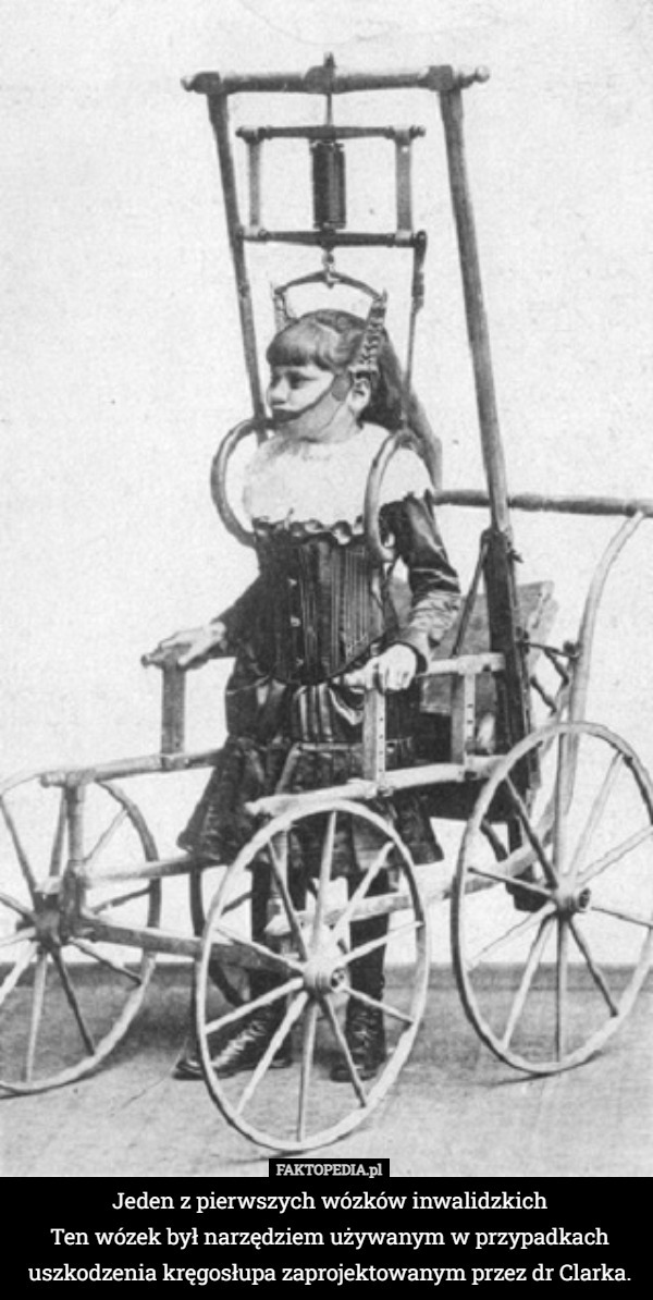 Jeden z pierwszych wózków inwalidzkich
 Ten wózek był narzędziem używanym w przypadkach uszkodzenia kręgosłupa zaprojektowanym przez dr Clarka. 