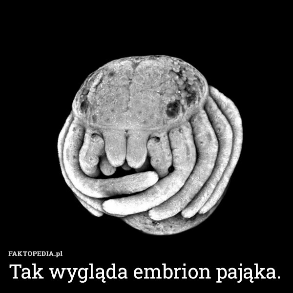 Tak wygląda embrion pająka. 