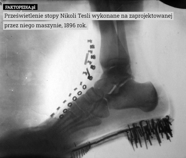 Prześwietlenie stopy Nikoli Tesli wykonane na zaprojektowanej przez niego maszynie, 1896 rok. 