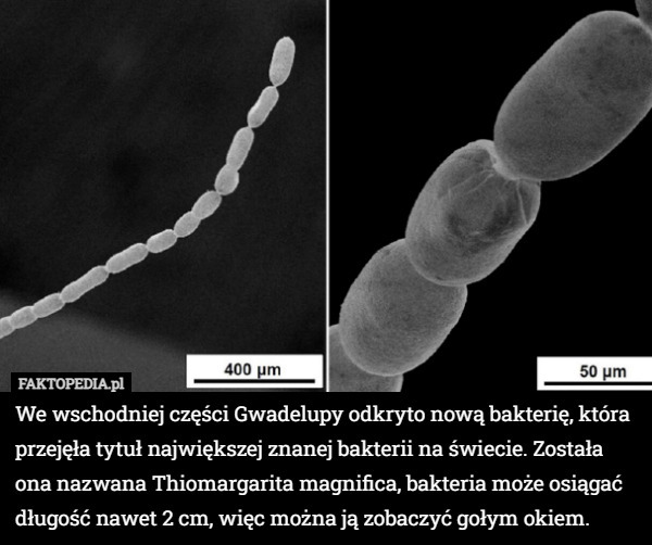 We wschodniej części Gwadelupy odkryto nową bakterię, która przejęła tytuł największej znanej bakterii na świecie. Została ona nazwana Thiomargarita magnifica, bakteria może osiągać długość nawet 2 cm, więc można ją zobaczyć gołym okiem. 