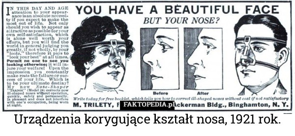 Urządzenia korygujące kształt nosa, 1921 rok. 