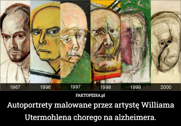 Autoportrety malowane przez artystę Williama Utermohlena chorego na alzheimera. 