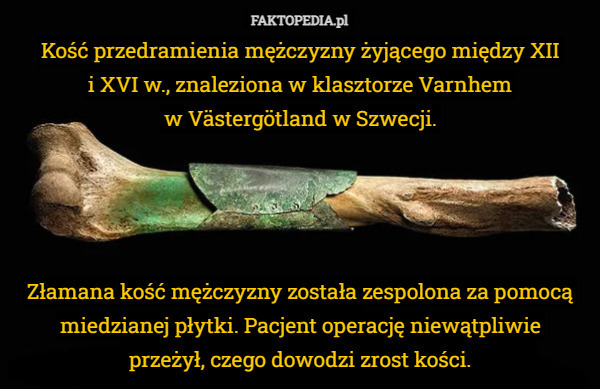 Kość przedramienia mężczyzny żyjącego między XII
 i XVI w., znaleziona w klasztorze Varnhem
 w Västergötland w Szwecji. Złamana kość mężczyzny została zespolona za pomocą miedzianej płytki. Pacjent operację niewątpliwie
 przeżył, czego dowodzi zrost kości. 