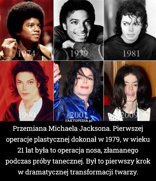 Przemiana Michaela Jacksona. Pierwszej operacje plastycznej dokonał w 1979, w wieku 21 lat była to operacja nosa, złamanego podczas próby tanecznej. Był to pierwszy krok w dramatycznej transformacji twarzy. 