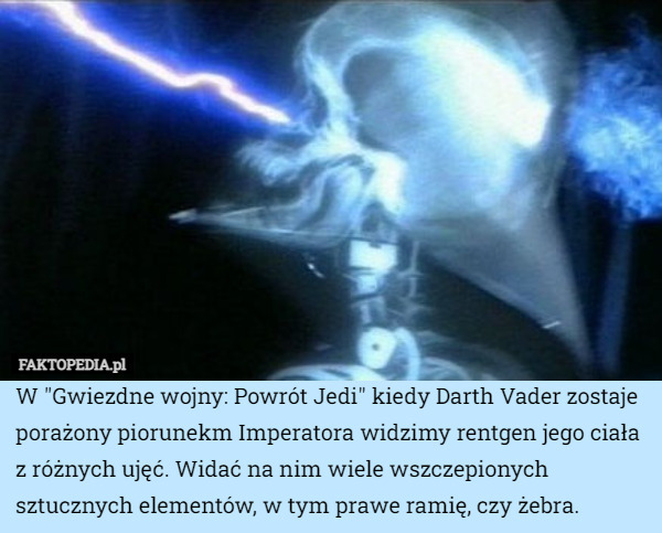 W "Gwiezdne wojny: Powrót Jedi" kiedy Darth Vader zostaje porażony piorunekm Imperatora widzimy rentgen jego ciała z różnych ujęć. Widać na nim wiele wszczepionych sztucznych elementów, w tym prawe ramię, czy żebra. 