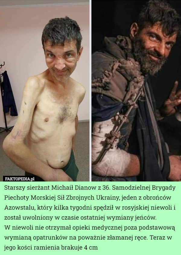 Starszy sierżant Michaił Dianow z 36. Samodzielnej Brygady Piechoty Morskiej Sił Zbrojnych Ukrainy, jeden z obrońców Azowstalu, który kilka tygodni spędził w rosyjskiej niewoli i został uwolniony w czasie ostatniej wymiany jeńców.
 W niewoli nie otrzymał opieki medycznej poza podstawową wymianą opatrunków na poważnie złamanej ręce. Teraz w jego kości ramienia brakuje 4 cm 