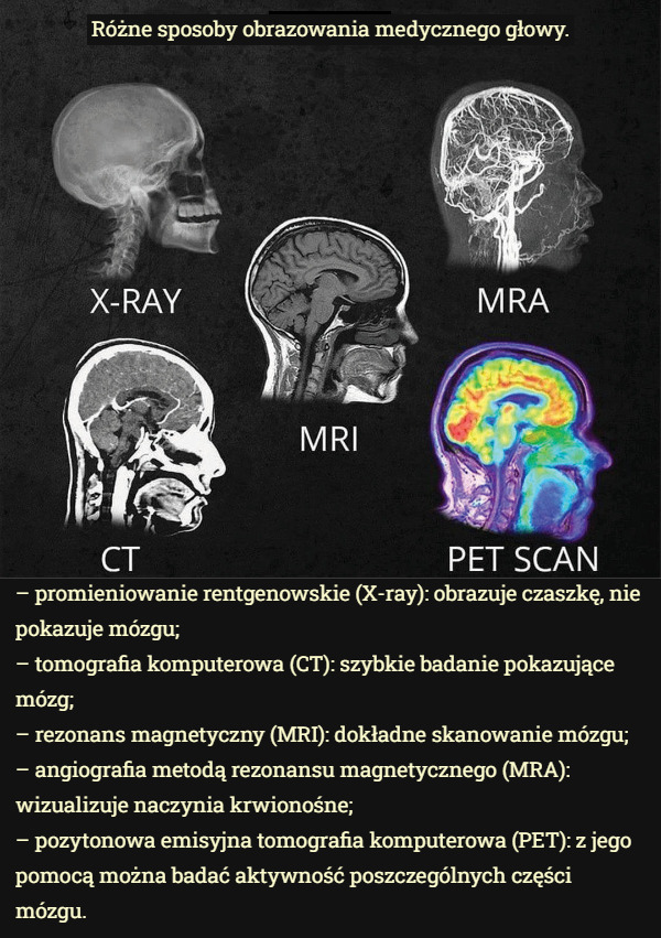 Różne sposoby obrazowania medycznego głowy. – promieniowanie rentgenowskie (X-ray): obrazuje czaszkę, nie pokazuje mózgu;
– tomografia komputerowa (CT): szybkie badanie pokazujące mózg;
– rezonans magnetyczny (MRI): dokładne skanowanie mózgu;
– angiografia metodą rezonansu magnetycznego (MRA): wizualizuje naczynia krwionośne;
– pozytonowa emisyjna tomografia komputerowa (PET): z jego pomocą można badać aktywność poszczególnych części mózgu. 