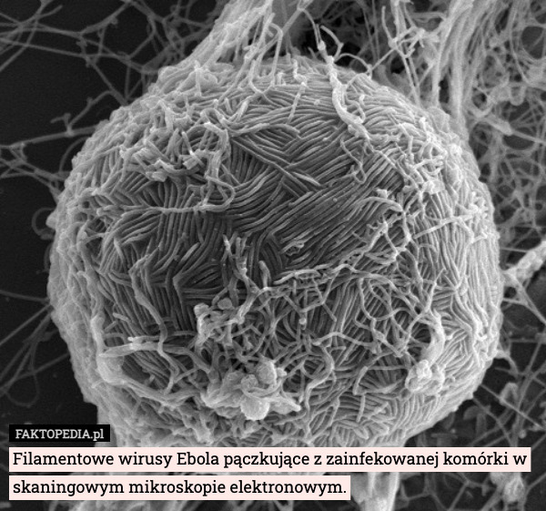 Filamentowe wirusy Ebola pączkujące z zainfekowanej komórki w skaningowym mikroskopie elektronowym. 
