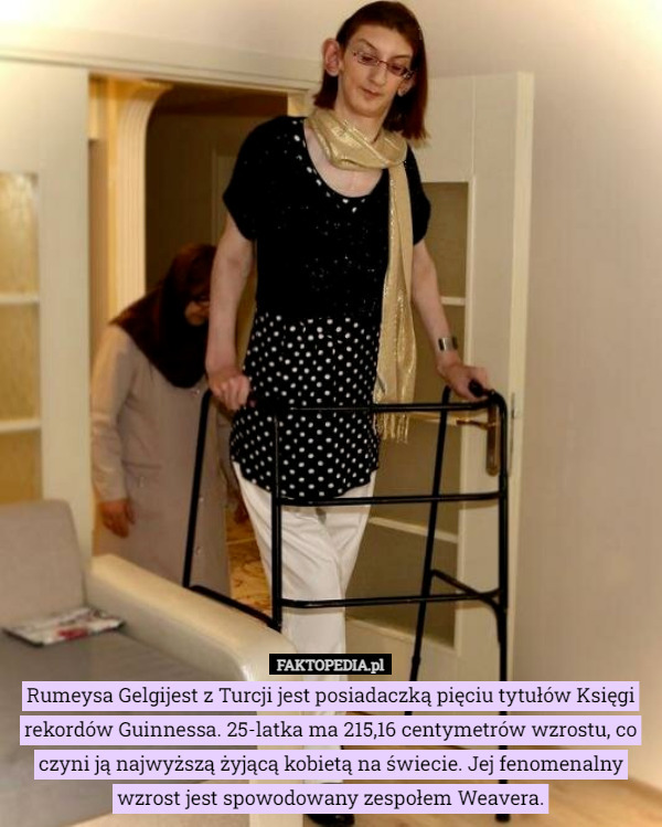 Rumeysa Gelgijest z Turcji jest posiadaczką pięciu tytułów Księgi rekordów Guinnessa. 25-latka ma 215,16 centymetrów wzrostu, co czyni ją najwyższą żyjącą kobietą na świecie. Jej fenomenalny wzrost jest spowodowany zespołem Weavera. 