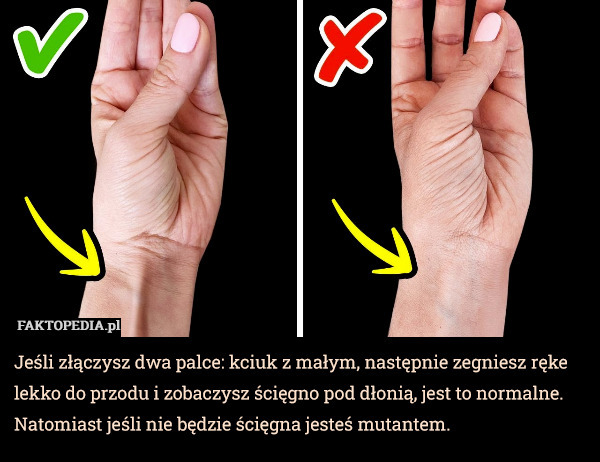 Jeśli złączysz dwa palce: kciuk z małym, następnie zegniesz ręke lekko do przodu i zobaczysz ścięgno pod dłonią, jest to normalne. Natomiast jeśli nie będzie ścięgna jesteś mutantem. 