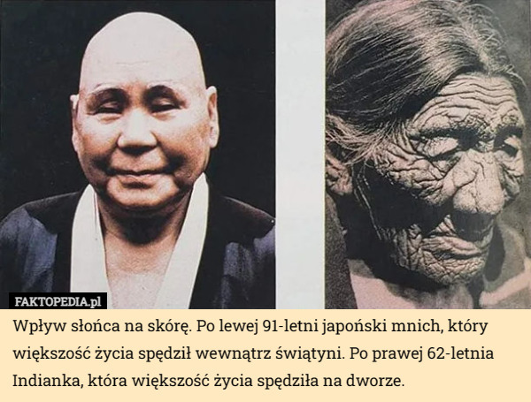 Wpływ słońca na skórę. Po lewej 91-letni japoński mnich, który większość życia spędził wewnątrz świątyni. Po prawej 62-letnia Indianka, która większość życia spędziła na dworze. 