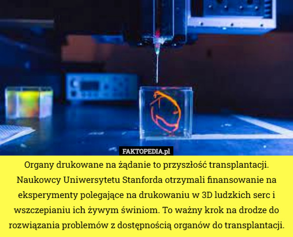 Organy drukowane na żądanie to przyszłość transplantacji.
 Naukowcy Uniwersytetu Stanforda otrzymali finansowanie na eksperymenty polegające na drukowaniu w 3D ludzkich serc i wszczepianiu ich żywym świniom. To ważny krok na drodze do rozwiązania problemów z dostępnością organów do transplantacji. 