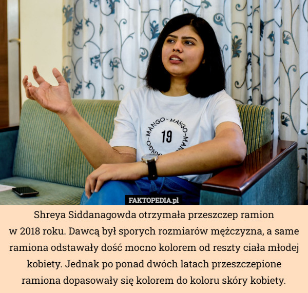 Shreya Siddanagowda otrzymała przeszczep ramion
 w 2018 roku. Dawcą był sporych rozmiarów mężczyzna, a same ramiona odstawały dość mocno kolorem od reszty ciała młodej kobiety. Jednak po ponad dwóch latach przeszczepione ramiona dopasowały się kolorem do koloru skóry kobiety. 
