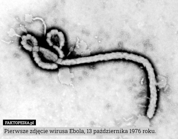 Pierwsze zdjęcie wirusa Ebola, 13 października 1976 roku. 
