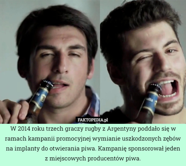 W 2014 roku trzech graczy rugby z Argentyny poddało się w ramach kampanii promocyjnej wymianie uszkodzonych zębów na implanty do otwierania piwa. Kampanię sponsorował jeden z miejscowych producentów piwa. 