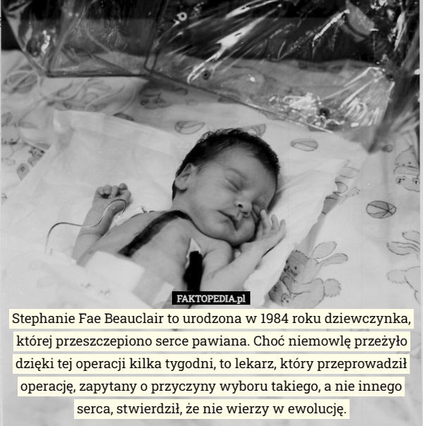 Stephanie Fae Beauclair to urodzona w 1984 roku dziewczynka, której przeszczepiono serce pawiana. Choć niemowlę przeżyło dzięki tej operacji kilka tygodni, to lekarz, który przeprowadził operację, zapytany o przyczyny wyboru takiego, a nie innego serca, stwierdził, że nie wierzy w ewolucję. 