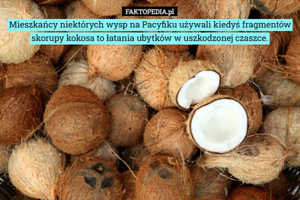 Mieszkańcy niektórych wysp na Pacyfiku używali kiedyś fragmentów skorupy kokosa to łatania ubytków w uszkodzonej czaszce. 