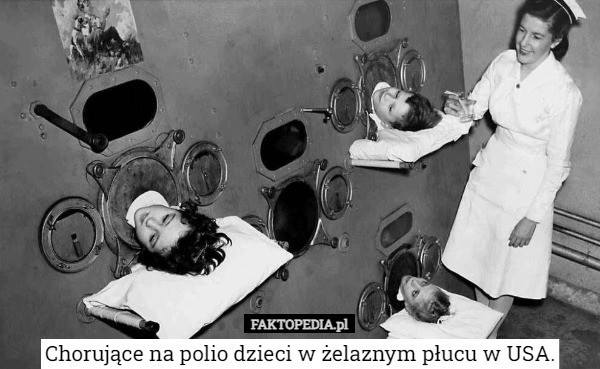 Chorujące na polio dzieci w żelaznym płucu w USA. 